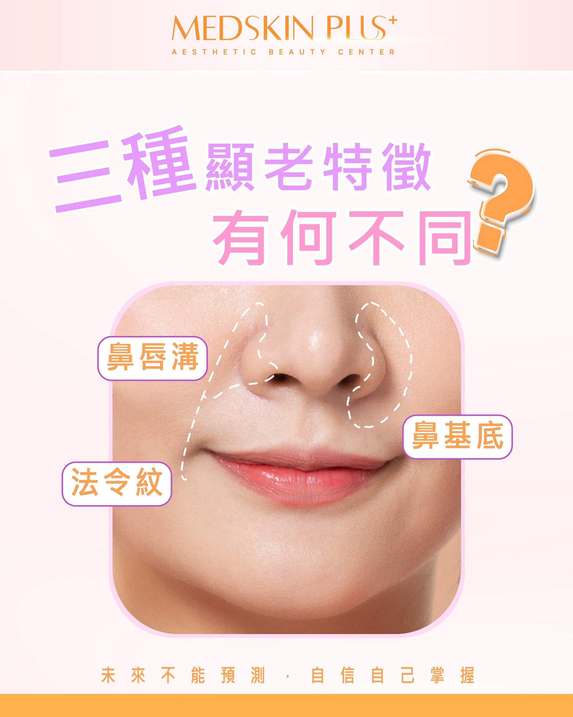 鼻基底凹陷全攻略(2025香港)：告別凹臉與法令紋，重塑立體輪廓 - Medskin Plus