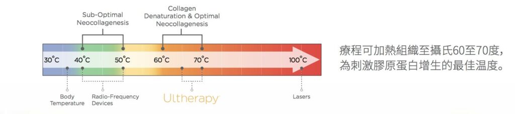 由 30°C 至 100°C 的橫向溫度軸圖表，標示射頻儀器、Ultherapy 與激光的作用溫度範圍