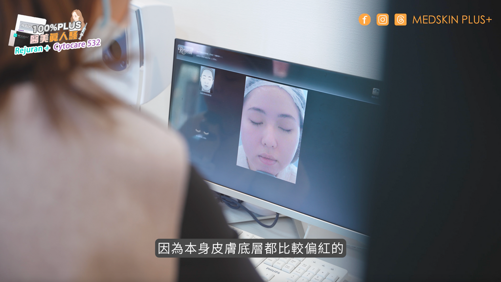 麗珠蘭 rejuran 療程過程