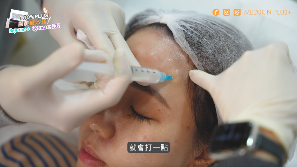 麗珠蘭 rejuran 注射