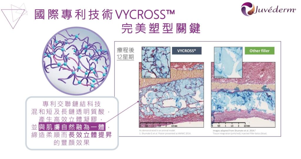 Juvederm VYCROSS技術圖解，左側為凝膠結構示意圖，右側比較VYCROSS與其他填充劑的組織切片。