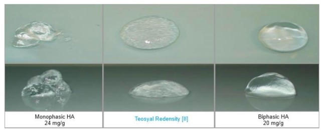 兩行共六粒透明凝膠樣本置於深綠灰色底板，下方標示 Monophasic HA 24 mg/g、Teosyal Redensity [I] 與 Biphasic HA 20 mg/g