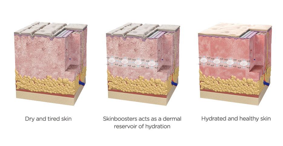 三張並排的皮膚橫切面示意圖，分別標示 Dry and tired skin 與 Hydrated and healthy skin。