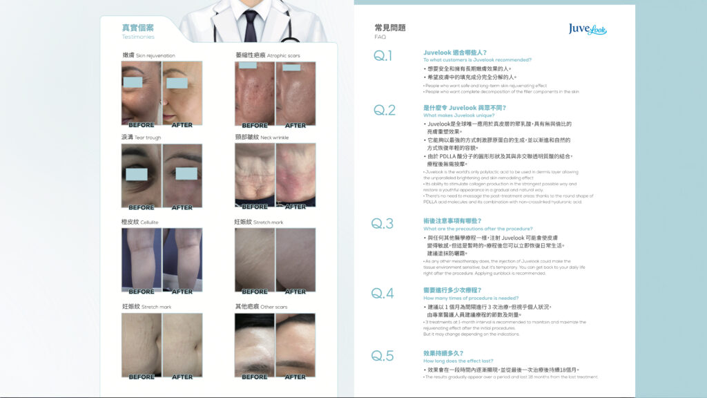 左側列出六組不同部位的療程前後對比照片，右側為 Juvelook 五條常見問題問答版面，並有身穿白袍的醫生示意人物。