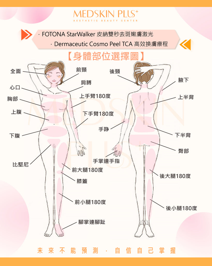 Fotona Starwalker / Cosmo Peel 身體部位選擇圖