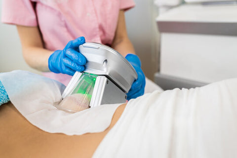 Ultimate Cryolipolysis - Cool Contouring