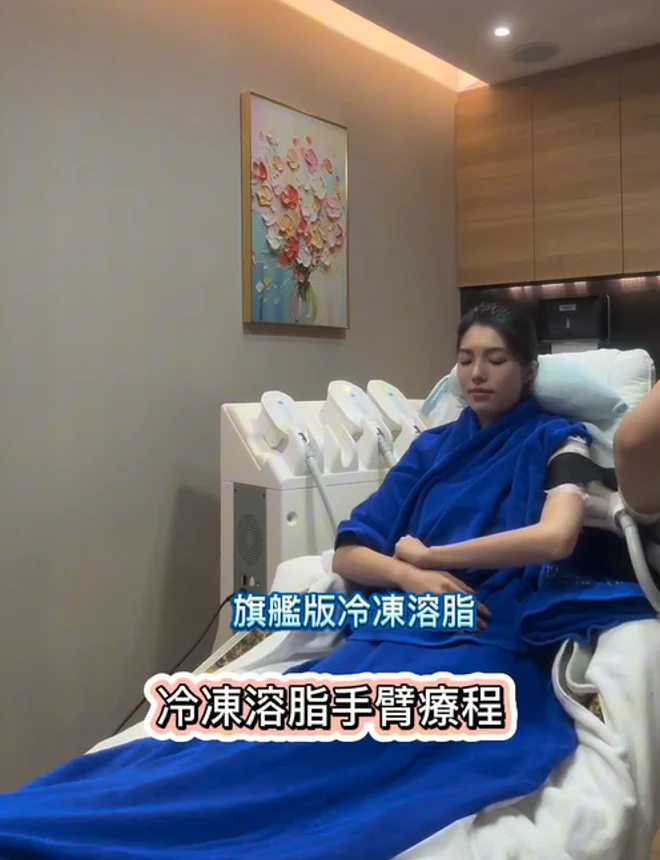 女客人身穿藍色療程袍平躺於療程床，手臂套上冷凍溶脂儀器探頭並以固定帶繫緊，畫面下方有中文字幕