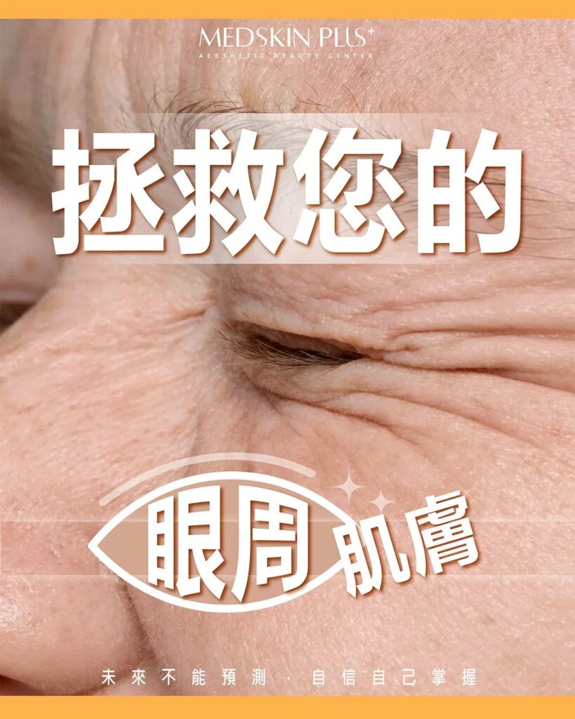 暖色調特寫宣傳圖，畫面為長者眼部及眼周皺紋近攝，中央疊上白色大字拯救您的眼周肌膚，下方有一個白色眼睛線框圖案。
