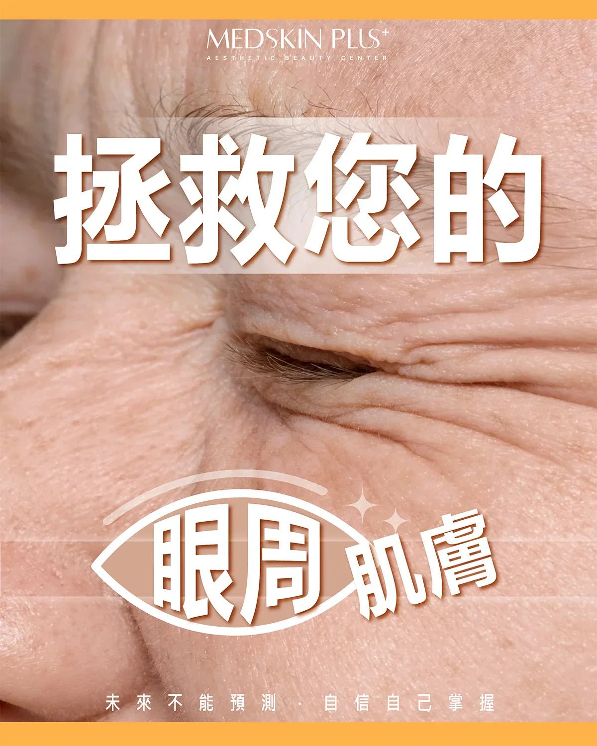 暖色調特寫宣傳圖，畫面為長者眼部及眼周皺紋近攝，中央疊上白色大字拯救您的眼周肌膚，下方有一個白色眼睛線框圖案。
