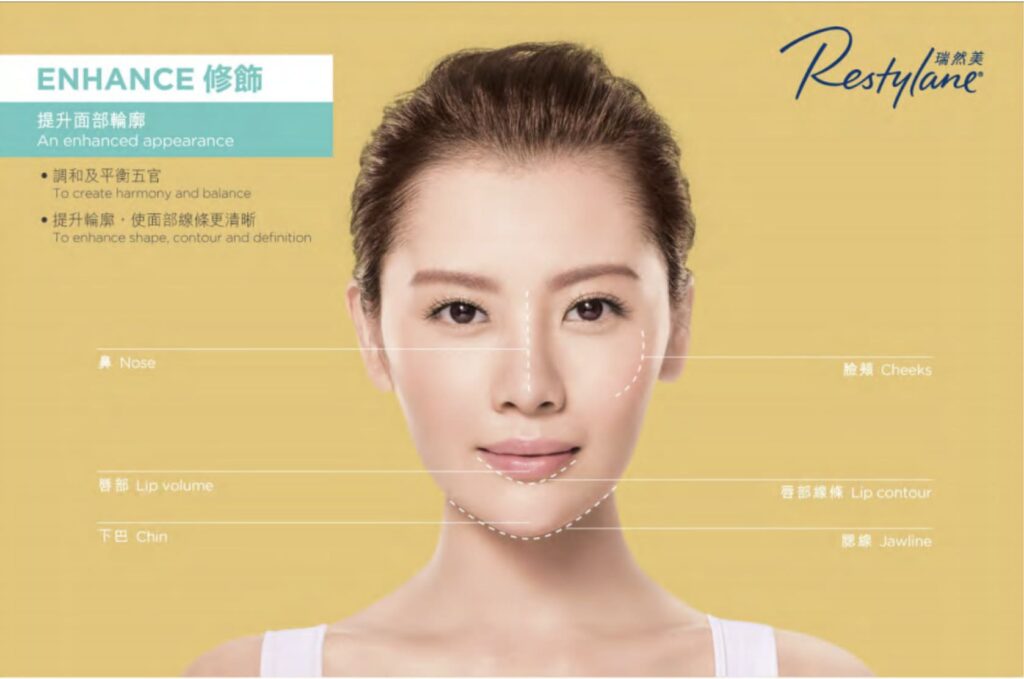 Restylane 瑞然美宣傳圖，中央為綁起頭髮的女士正面臉部特寫，臉旁以白色虛線標示輪廓，左右列出鼻、臉頰、唇部、唇部線條、下巴與下顎線位置，背景為黃色。