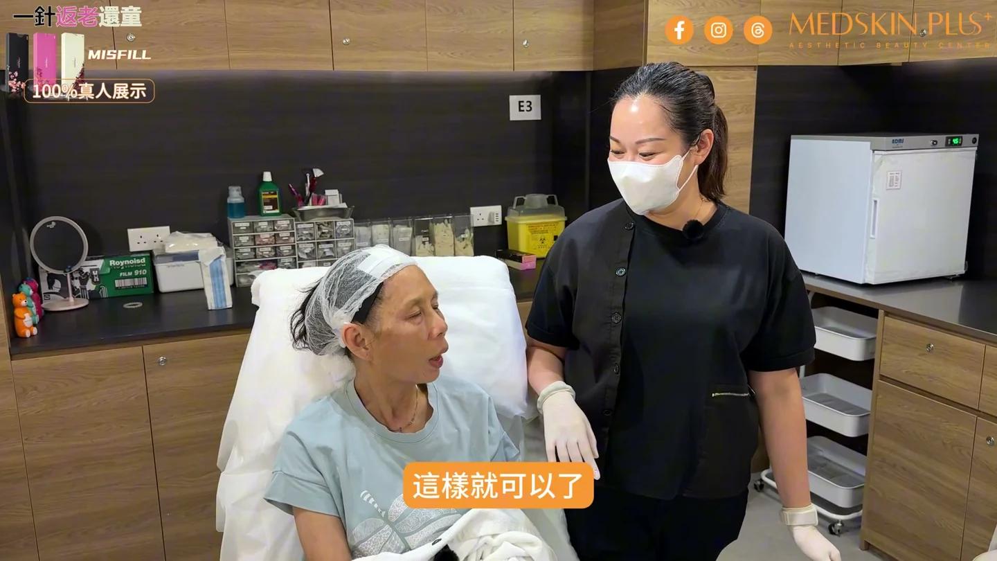 65歲模特兒完成療程後分享希望自然改善輪廓