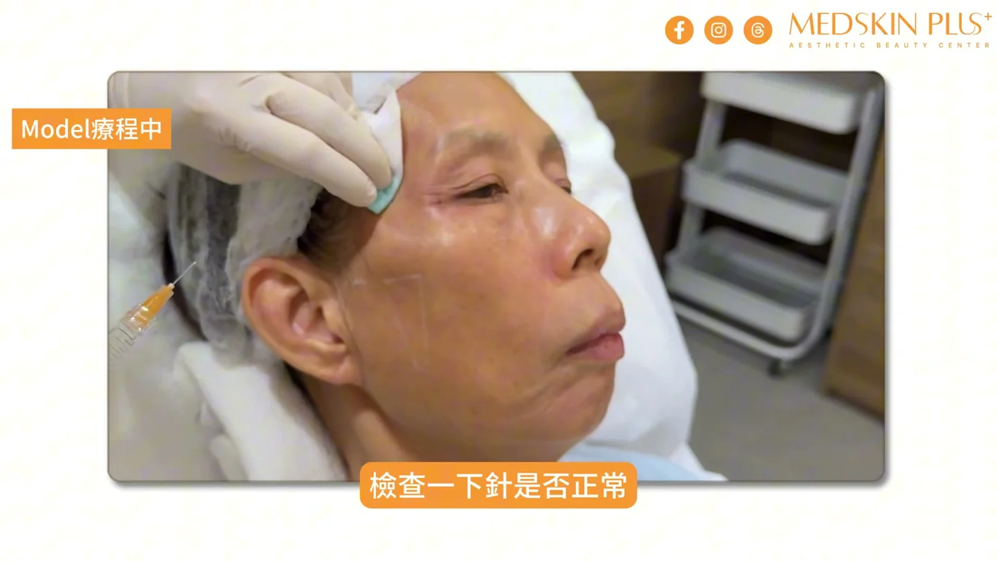 醫生注射透明質酸前清潔及檢查治療位置