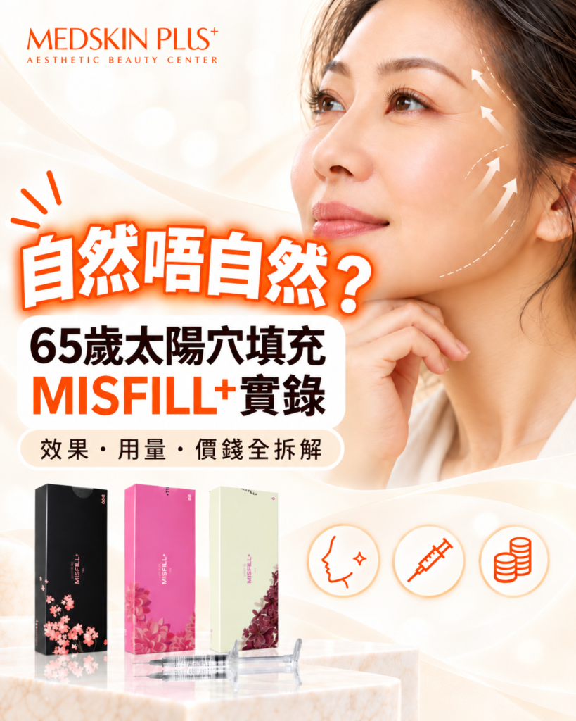 MISFILL+ 透明質酸填充｜65歲太陽穴實錄：效果、價錢與收費